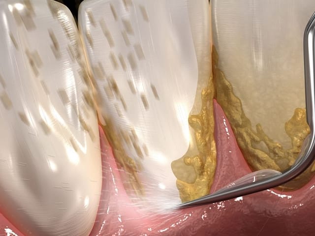 Signs You Might Need a Deep Cleaning (And Why It Matters)