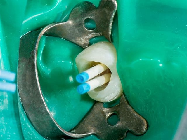 Emergency Dentist Cost NYC: What You Should Expect