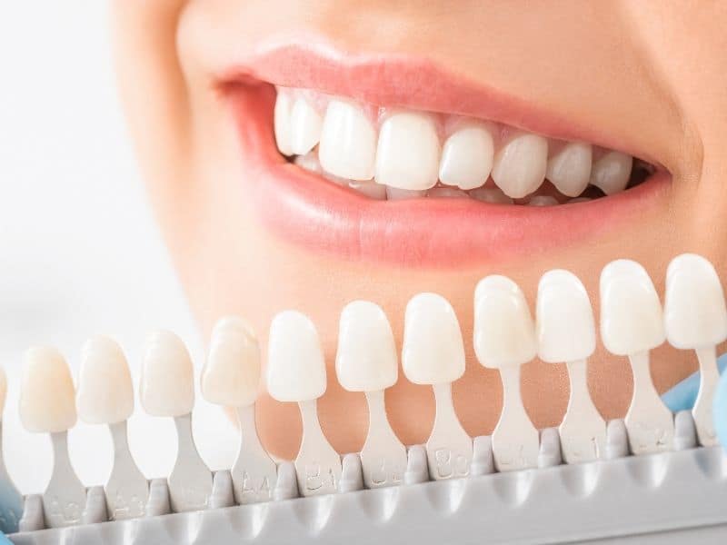 Benefits of a cosmetic smile makeover — healthy confident smile